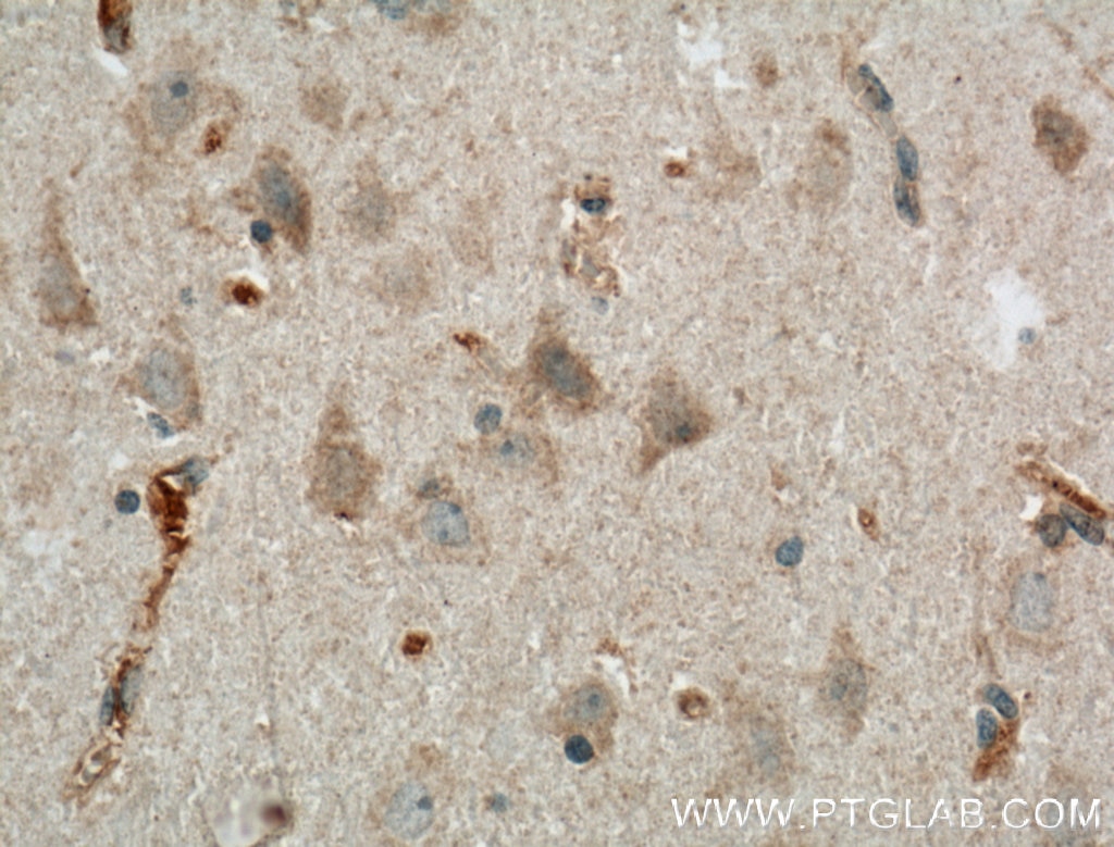 Immunohistochemistry (IHC) staining of human brain tissue using LRRTM3 Polyclonal antibody (27003-1-AP)