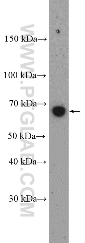 Western Blot (WB) analysis of Neuro-2a cells using LRRTM3 Polyclonal antibody (27003-1-AP)
