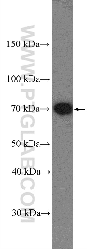 Western Blot (WB) analysis of mouse brain tissue using LRRTM3 Polyclonal antibody (27003-1-AP)