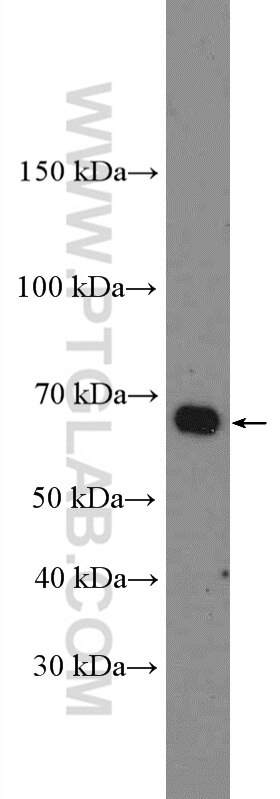 Western Blot (WB) analysis of rat brain tissue using LRRTM3 Polyclonal antibody (27003-1-AP)