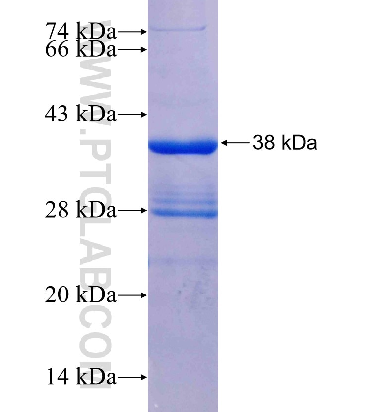 LRRTM3 fusion protein Ag25452 SDS-PAGE