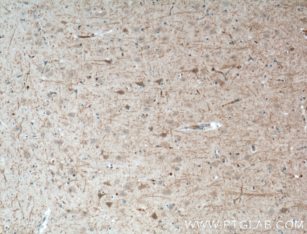 Immunohistochemistry (IHC) staining of human brain tissue using LRRTM4 Polyclonal antibody (16976-1-AP)