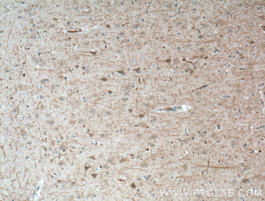 IHC staining of human brain using 16976-1-AP