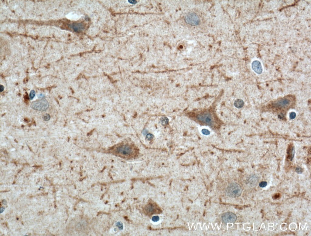 Immunohistochemistry (IHC) staining of human brain tissue using LRRTM4 Polyclonal antibody (16976-1-AP)