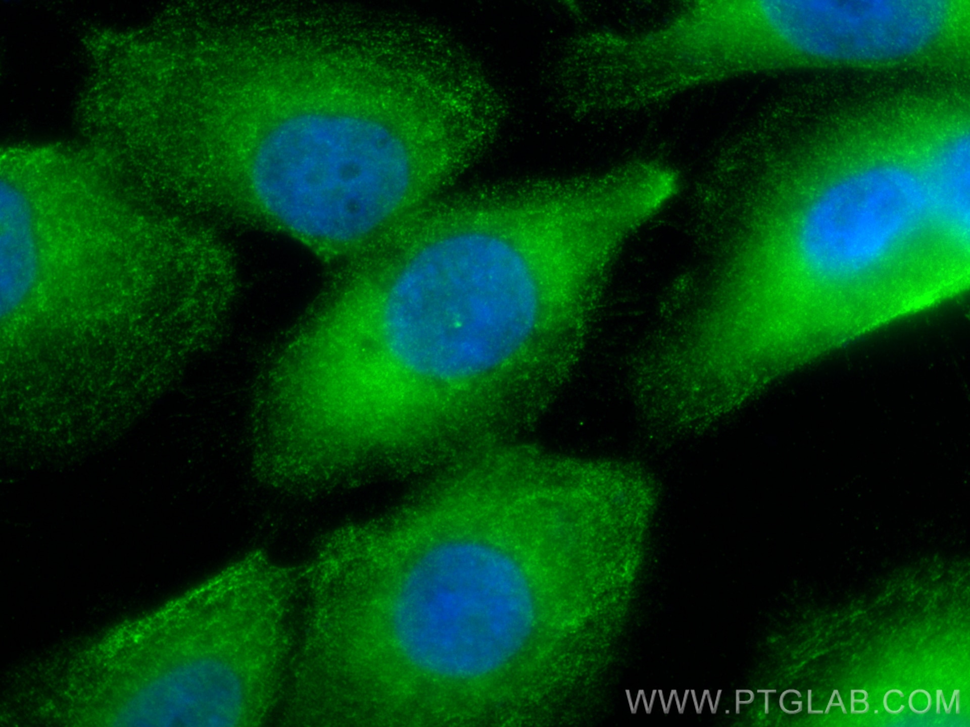 Immunofluorescence (IF) / fluorescent staining of A431 cells using LRSAM1 Polyclonal antibody (24666-1-AP)