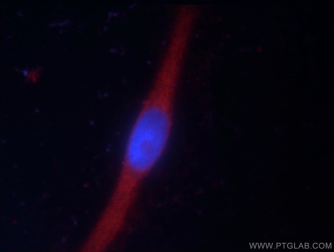 Immunofluorescence (IF) / fluorescent staining of A431 cells using LRSAM1 Polyclonal antibody (24666-1-AP)