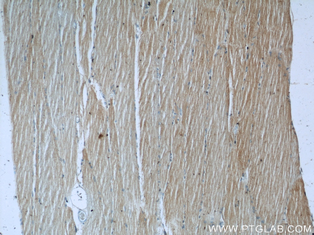 IHC staining of human skeletal muscle using 24666-1-AP