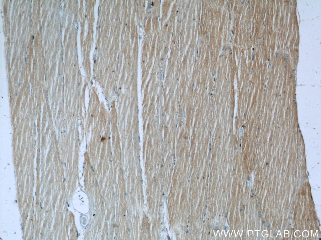 Immunohistochemistry (IHC) staining of human skeletal muscle tissue using LRSAM1 Polyclonal antibody (24666-1-AP)