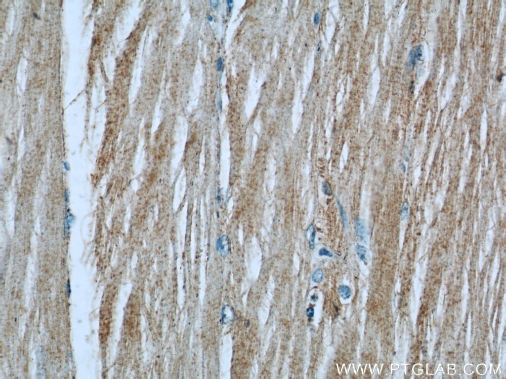 Immunohistochemistry (IHC) staining of human skeletal muscle tissue using LRSAM1 Polyclonal antibody (24666-1-AP)