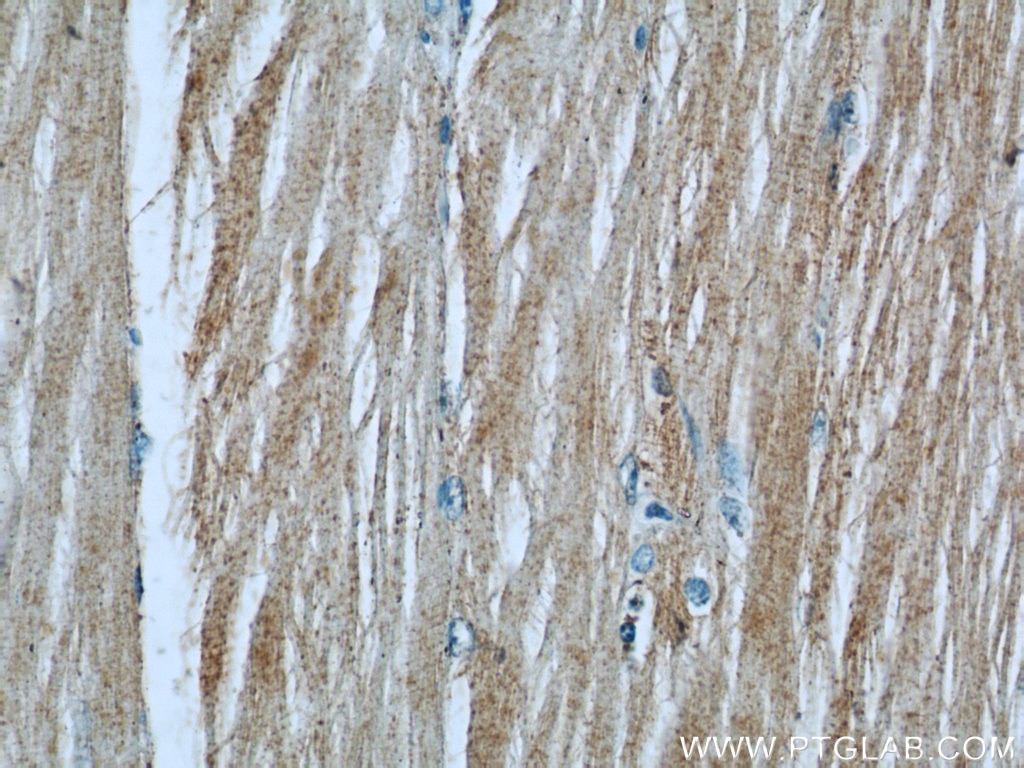 IHC staining of human skeletal muscle using 24666-1-AP