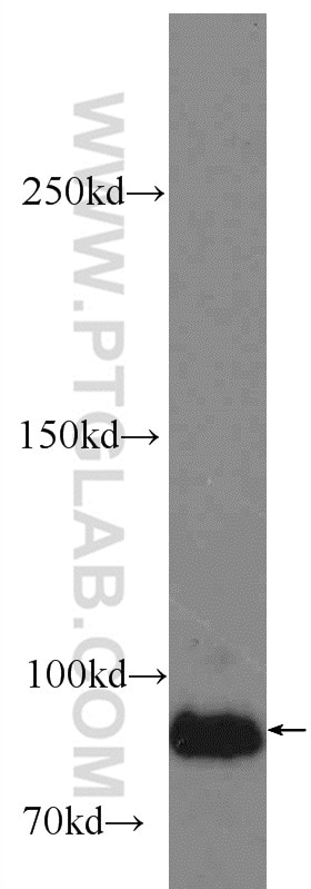 Western Blot (WB) analysis of HepG2 cells using LRSAM1 Polyclonal antibody (24666-1-AP)