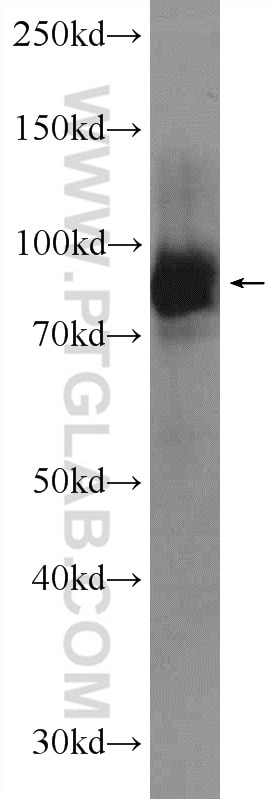 Western Blot (WB) analysis of Jurkat cells using LRSAM1 Polyclonal antibody (24666-1-AP)