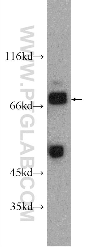 Western Blot (WB) analysis of mouse liver tissue using LRSAM1 Polyclonal antibody (24666-1-AP)