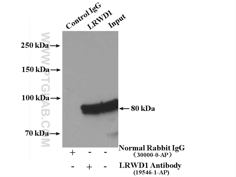 Immunoprecipitation (IP) experiment of mouse testis tissue using LRWD1 Polyclonal antibody (19546-1-AP)