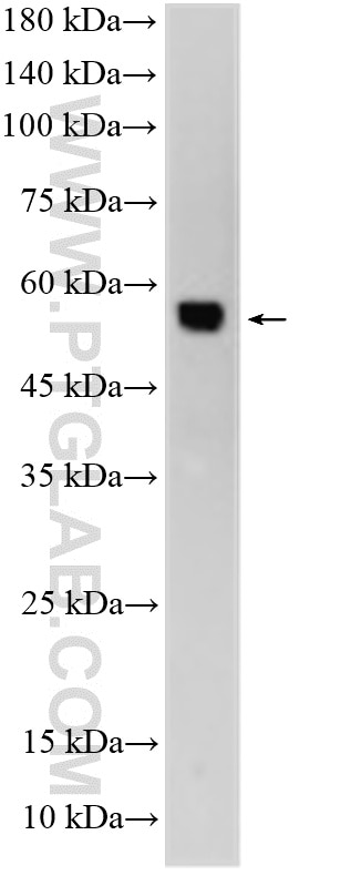 Western Blot (WB) analysis of SH-SY5Y cells using LSAMP Polyclonal antibody (13600-1-AP)