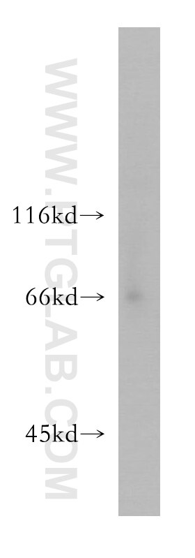 Western Blot (WB) analysis of human brain tissue using LSAMP Polyclonal antibody (13600-1-AP)