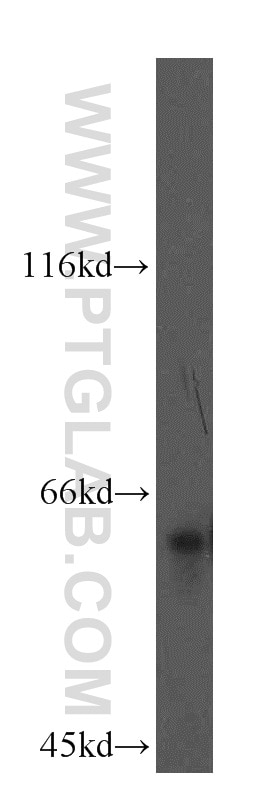 Western Blot (WB) analysis of mouse brain tissue using LSAMP Polyclonal antibody (13600-1-AP)