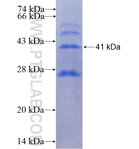 LSAMP fusion protein Ag14474 SDS-PAGE