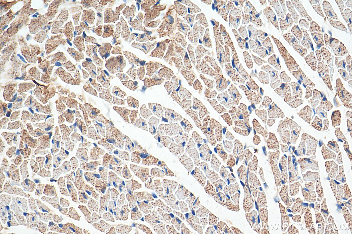 Immunohistochemistry (IHC) staining of mouse heart tissue using Perilipin 5 Polyclonal antibody (26951-1-AP)