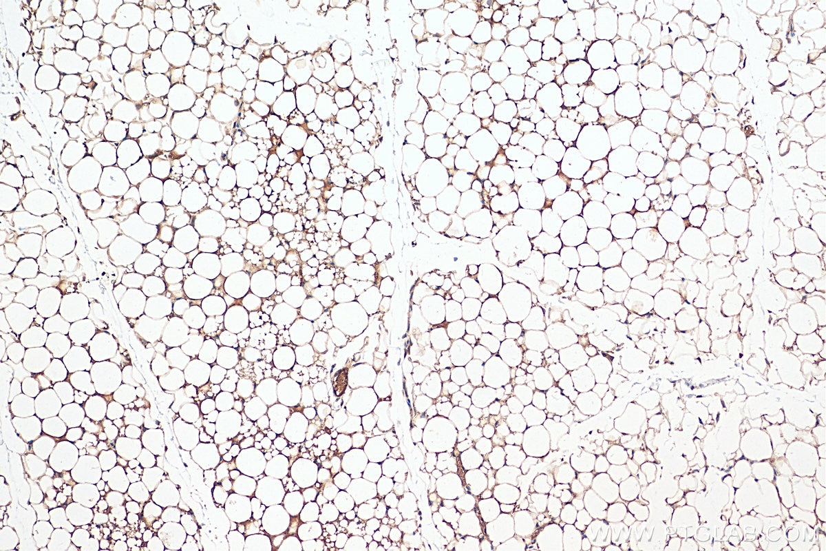 Immunohistochemistry (IHC) staining of mouse brown adipose tissue using Perilipin 5 Polyclonal antibody (26951-1-AP)