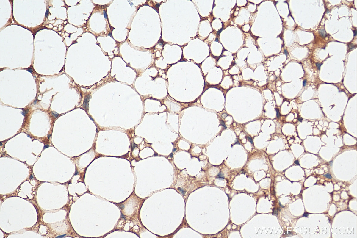 Immunohistochemistry (IHC) staining of mouse brown adipose tissue using Perilipin 5 Polyclonal antibody (26951-1-AP)