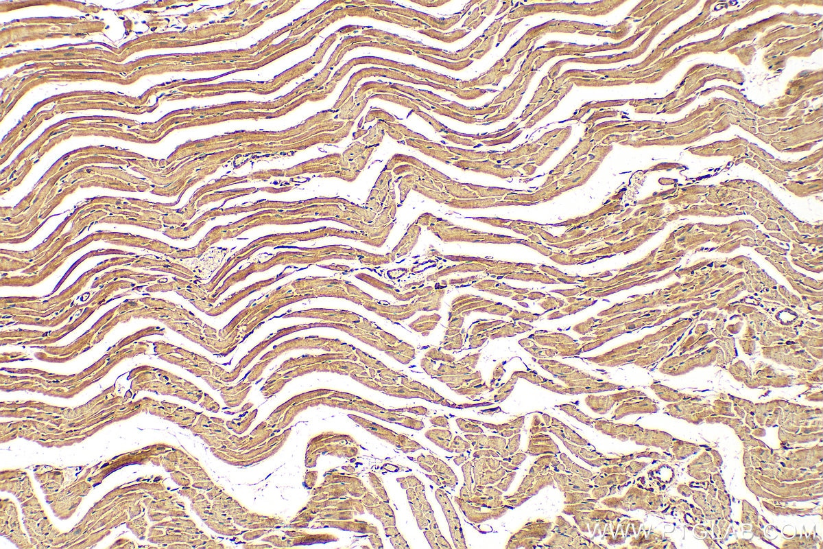 Immunohistochemistry (IHC) staining of mouse heart tissue using Perilipin 5 Polyclonal antibody (26951-1-AP)