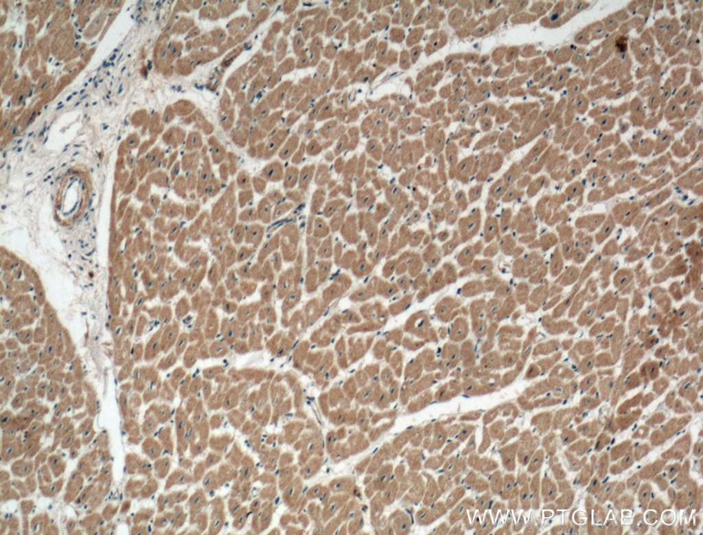 Immunohistochemistry (IHC) staining of human heart tissue using Perilipin 5 Polyclonal antibody (26951-1-AP)