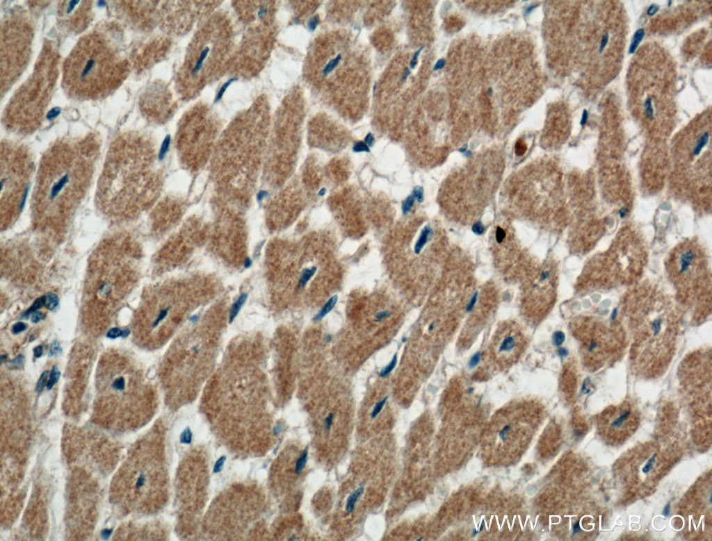 Immunohistochemistry (IHC) staining of human heart tissue using Perilipin 5 Polyclonal antibody (26951-1-AP)