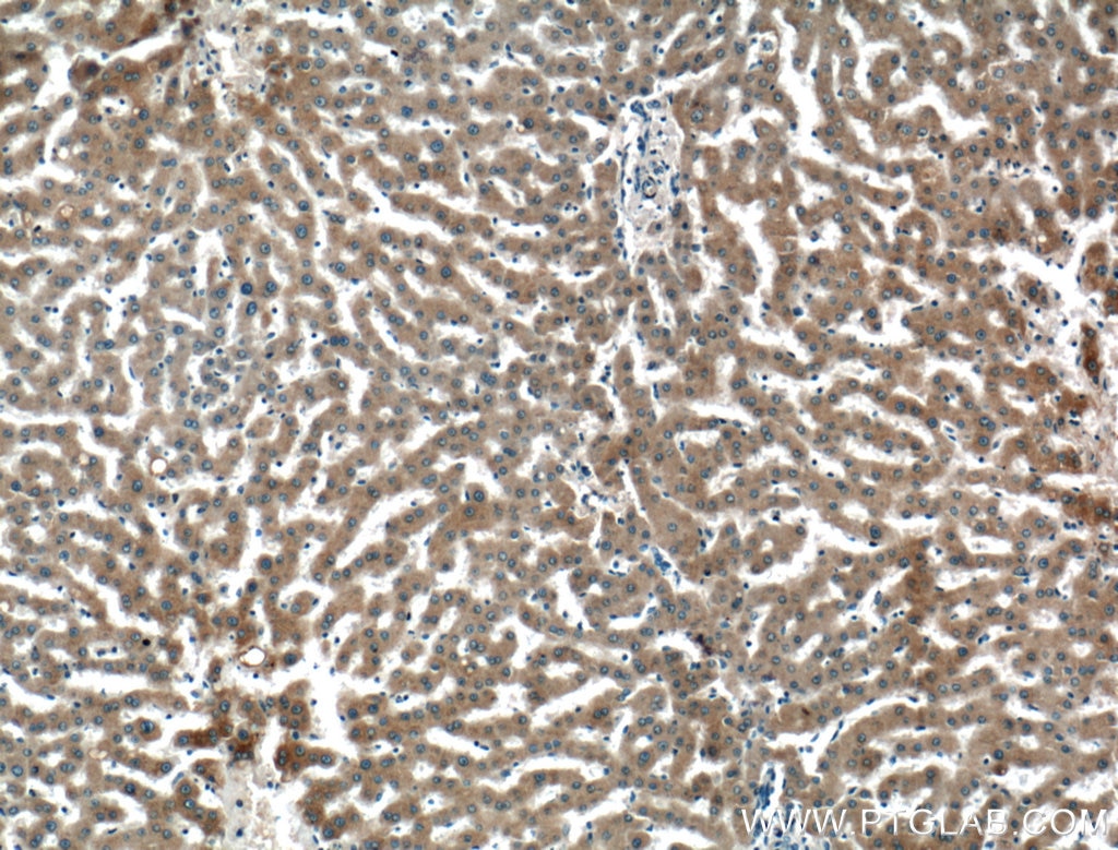 Immunohistochemistry (IHC) staining of human liver tissue using Perilipin 5 Polyclonal antibody (26951-1-AP)