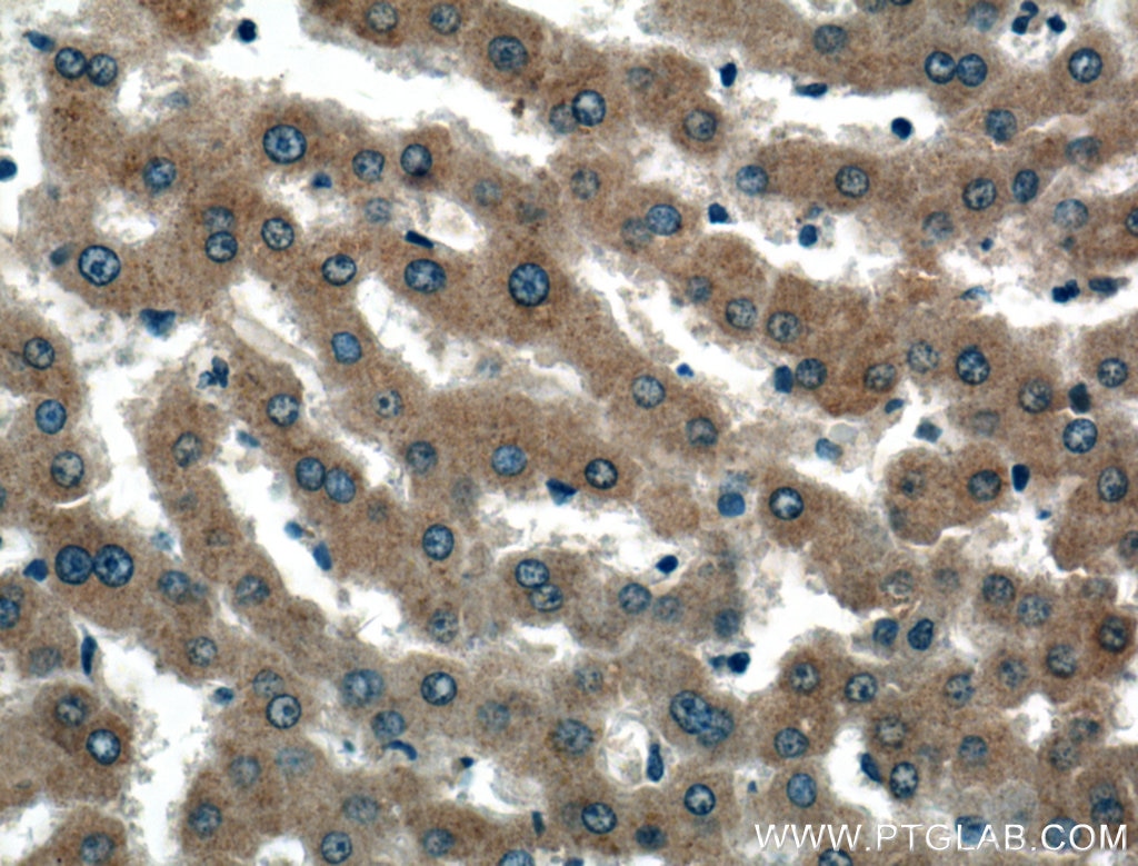 Immunohistochemistry (IHC) staining of human liver tissue using Perilipin 5 Polyclonal antibody (26951-1-AP)