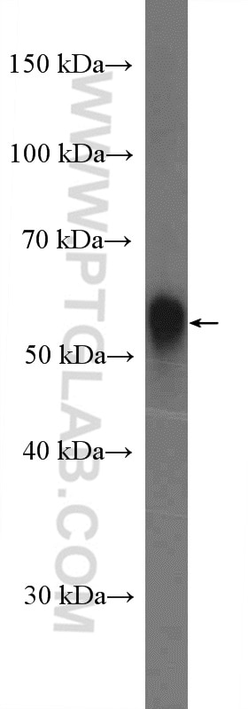 Western Blot (WB) analysis of pig heart tissue using Perilipin 5 Polyclonal antibody (26951-1-AP)