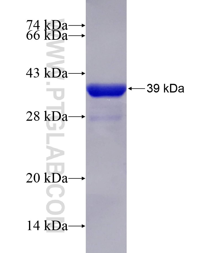 LSDP5 fusion protein Ag25272 SDS-PAGE