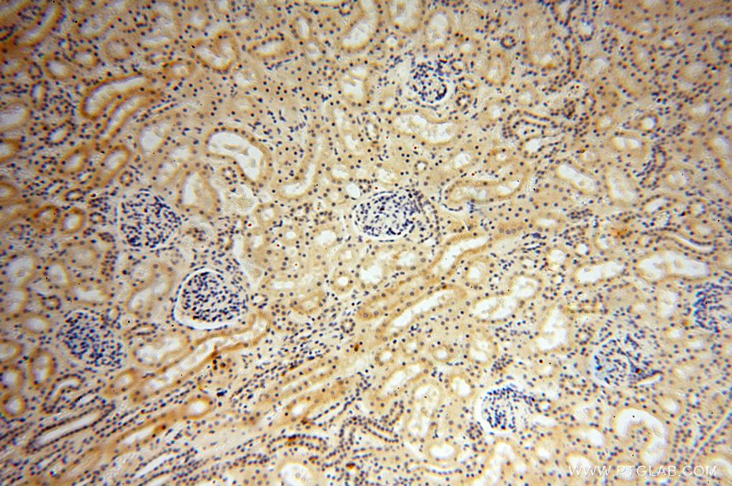 IHC staining of human kidney using 17750-1-AP