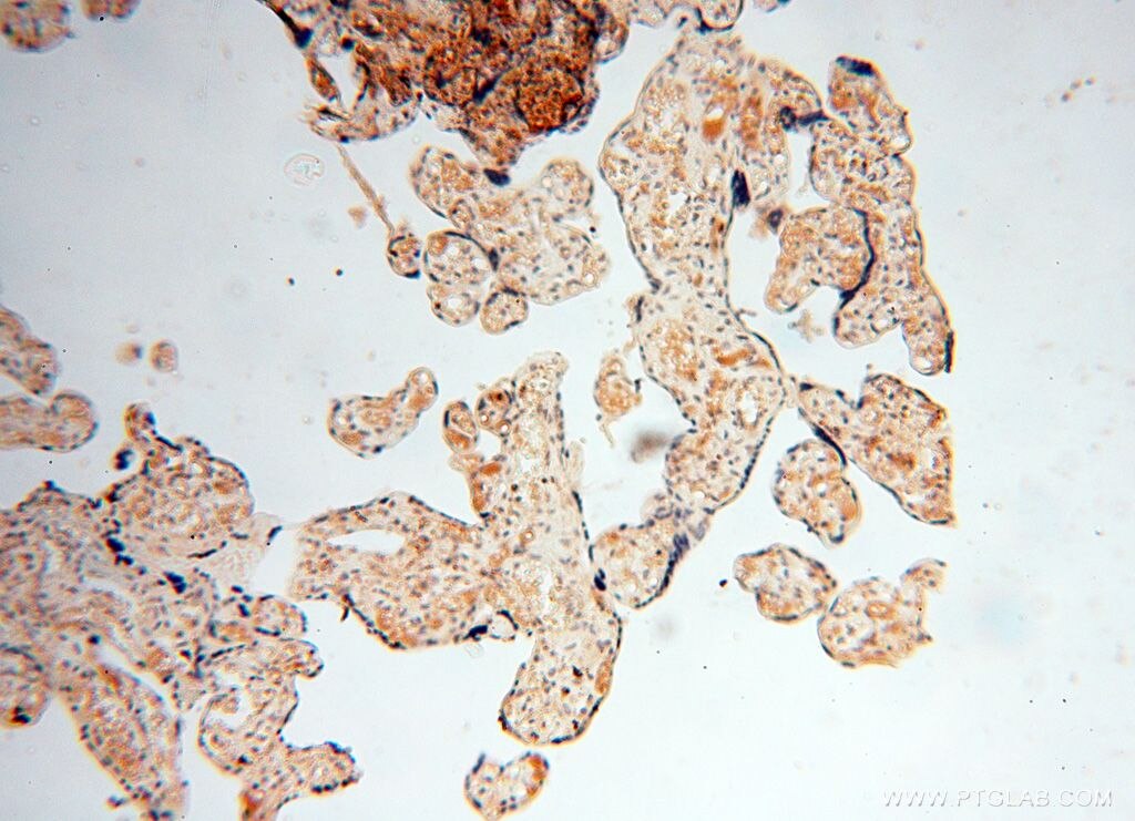 Immunohistochemistry (IHC) staining of human placenta tissue using LSG1 Polyclonal antibody (17750-1-AP)