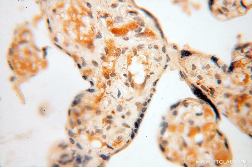 Immunohistochemistry (IHC) staining of human placenta tissue using LSG1 Polyclonal antibody (17750-1-AP)