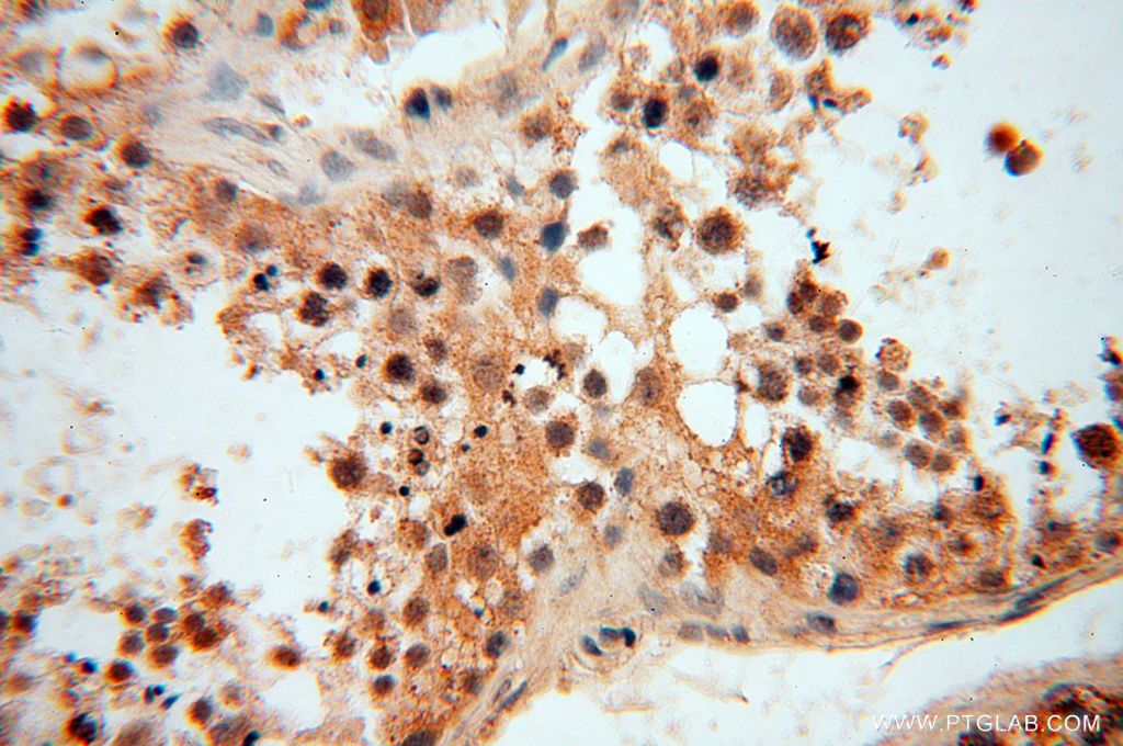 Immunohistochemistry (IHC) staining of human testis tissue using LSG1 Polyclonal antibody (17750-1-AP)