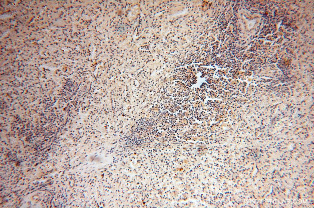 Immunohistochemistry (IHC) staining of human spleen tissue using LSG1 Polyclonal antibody (17750-1-AP)