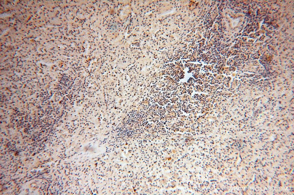 IHC staining of human spleen using 17750-1-AP