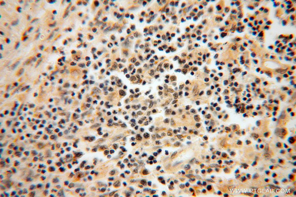 Immunohistochemistry (IHC) staining of human spleen tissue using LSG1 Polyclonal antibody (17750-1-AP)