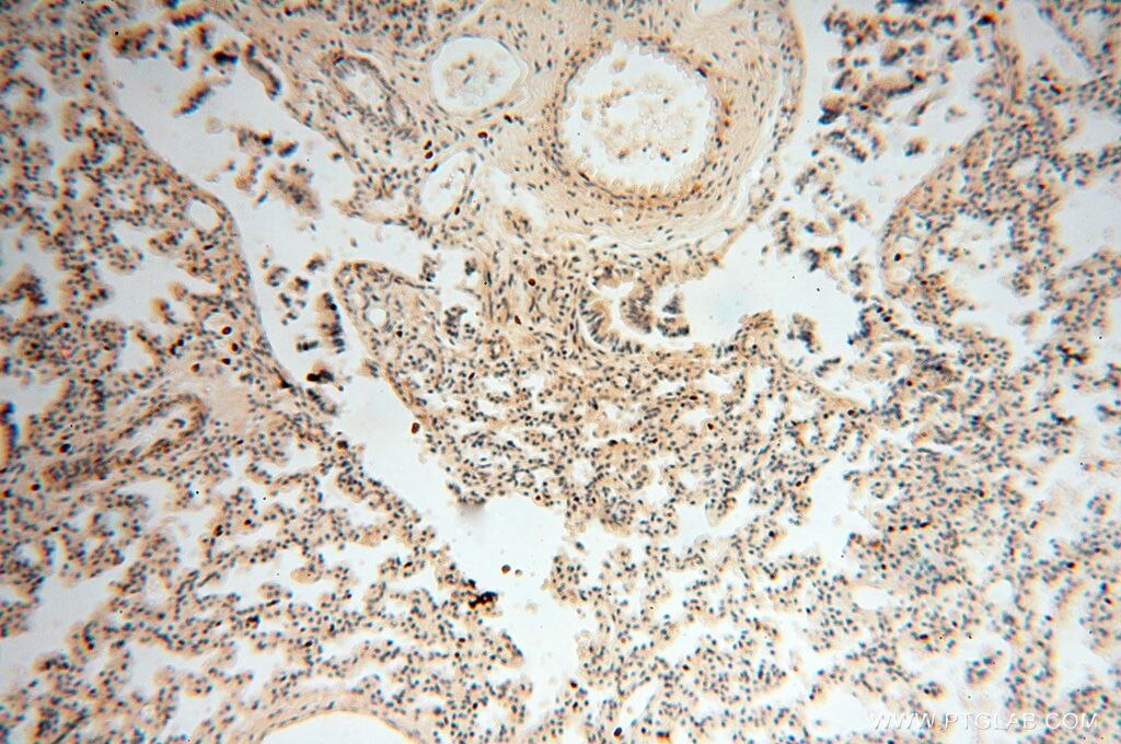 Immunohistochemistry (IHC) staining of human lung tissue using LSG1 Polyclonal antibody (17750-1-AP)