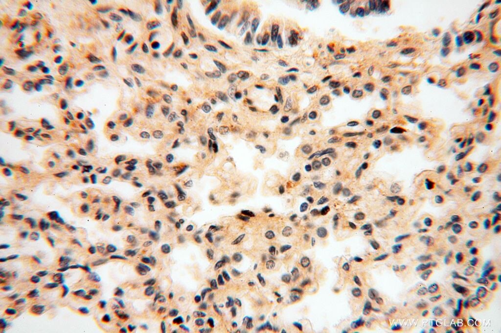 Immunohistochemistry (IHC) staining of human lung tissue using LSG1 Polyclonal antibody (17750-1-AP)