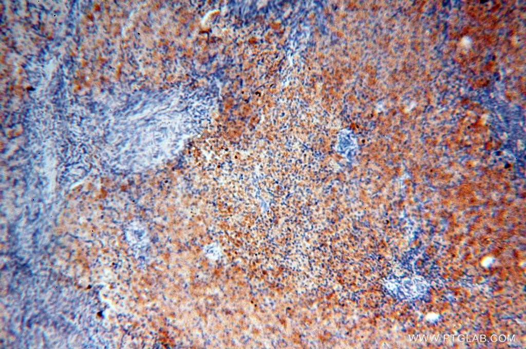 Immunohistochemistry (IHC) staining of human ovary tissue using LSG1 Polyclonal antibody (17750-1-AP)