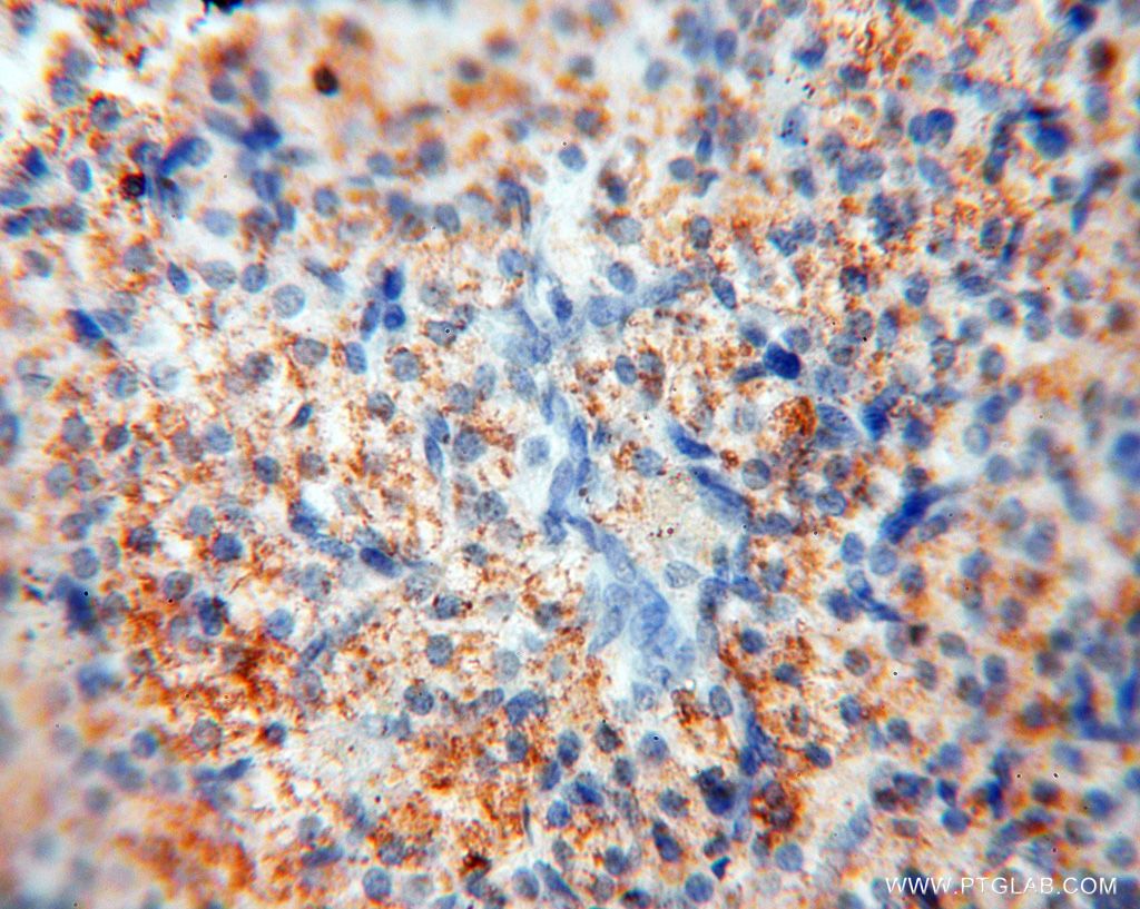 Immunohistochemistry (IHC) staining of human ovary tissue using LSG1 Polyclonal antibody (17750-1-AP)