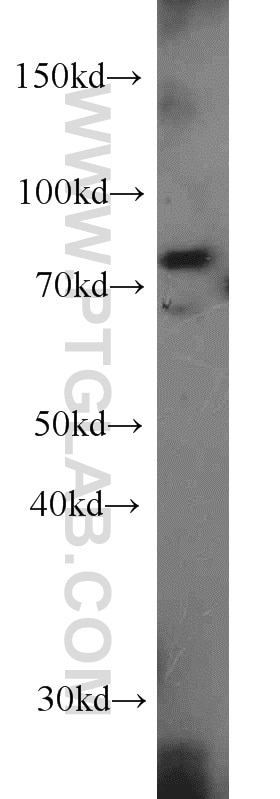 Western Blot (WB) analysis of HeLa cells using LSG1 Polyclonal antibody (17750-1-AP)