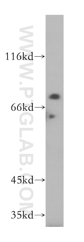 WB analysis of HeLa using 17750-1-AP