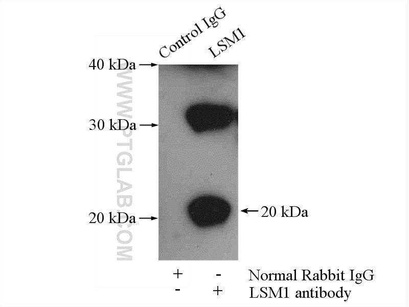 IP experiment of HeLa using 10259-1-AP