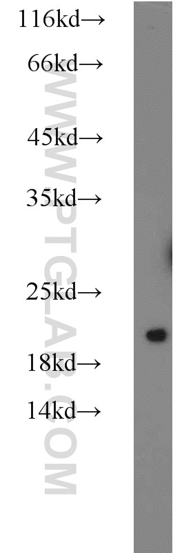 Western Blot (WB) analysis of HeLa cells using LSM1 Polyclonal antibody (10259-1-AP)