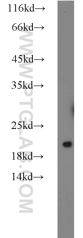 WB analysis of HeLa using 10259-1-AP