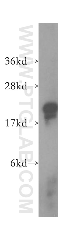 Western Blot (WB) analysis of mouse kidney tissue using LSM1 Polyclonal antibody (10259-1-AP)