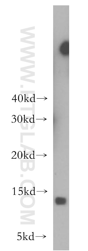 WB analysis of human spleen using 10874-1-AP